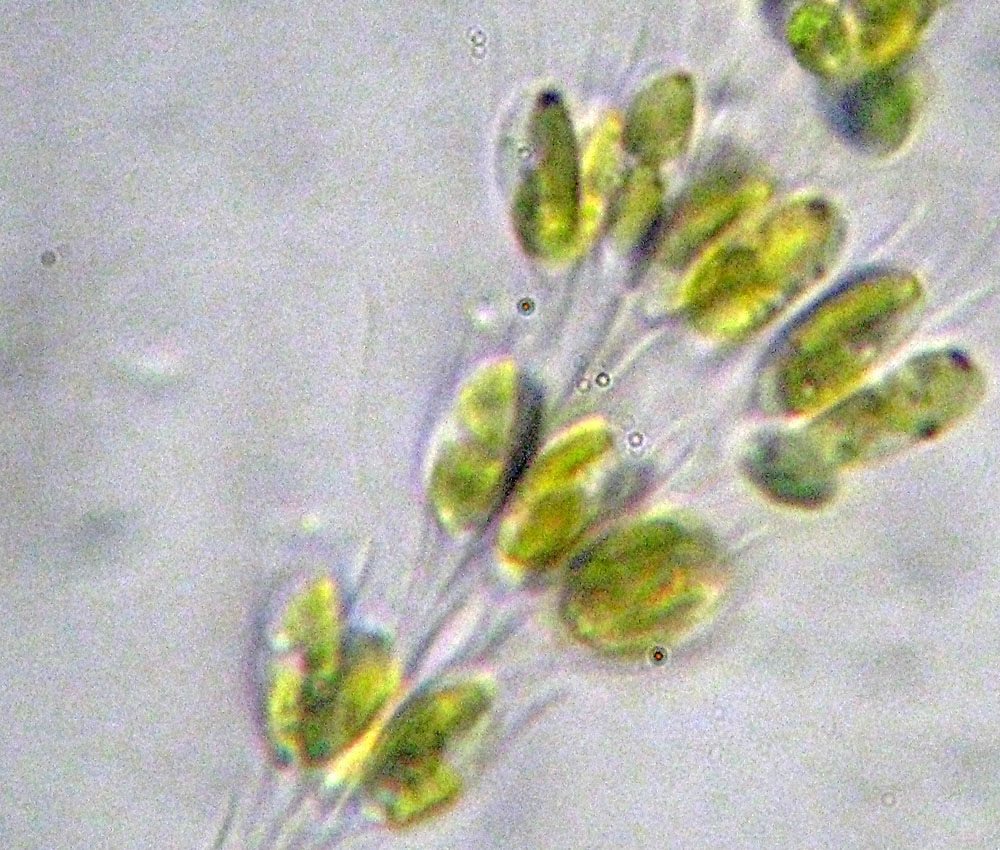 Dinobryon forse sertularia